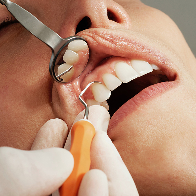 Orthodontie (Traitements Dentaires)